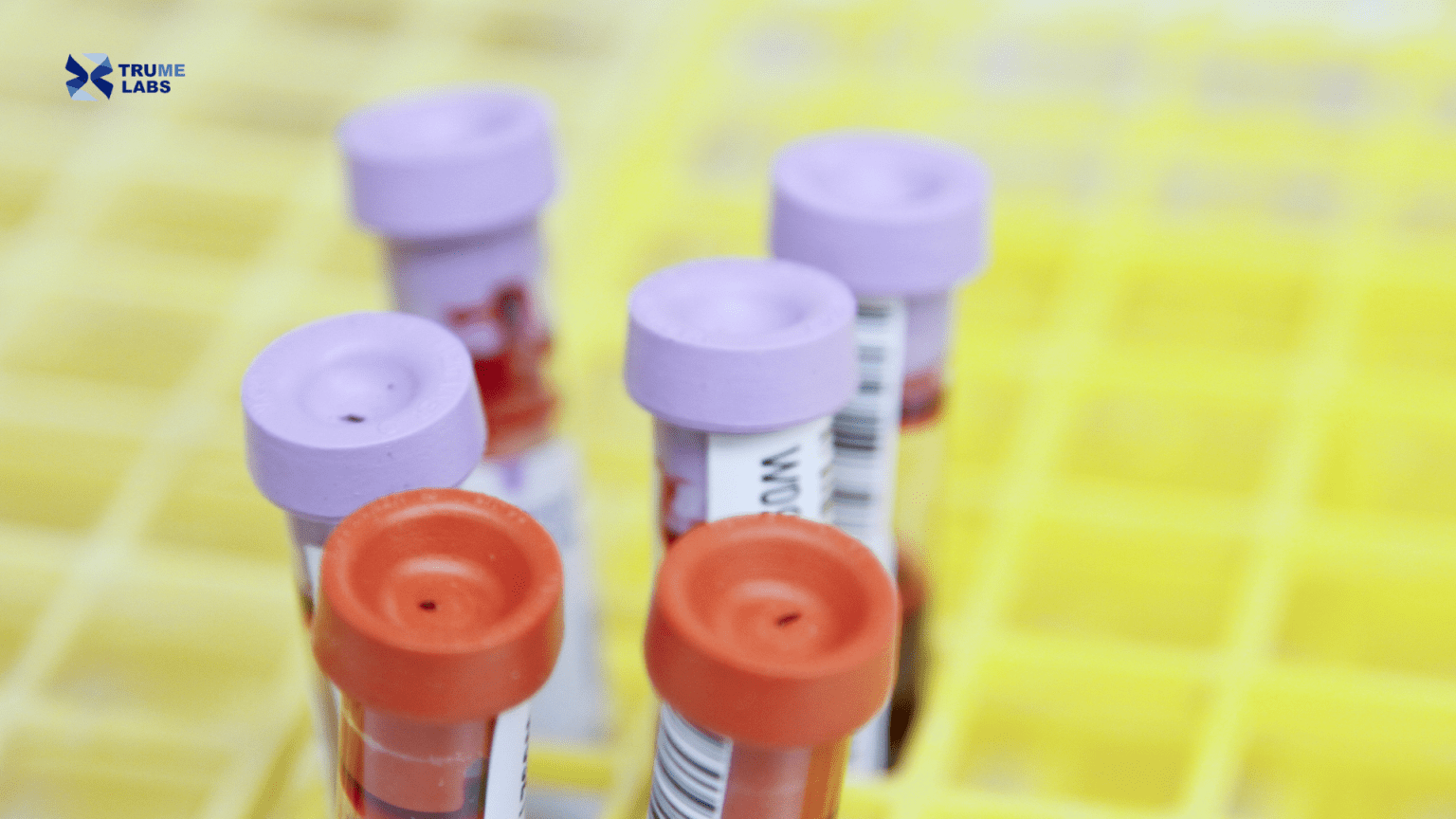 What Does the Methylation Test Tell You? Interpret Results