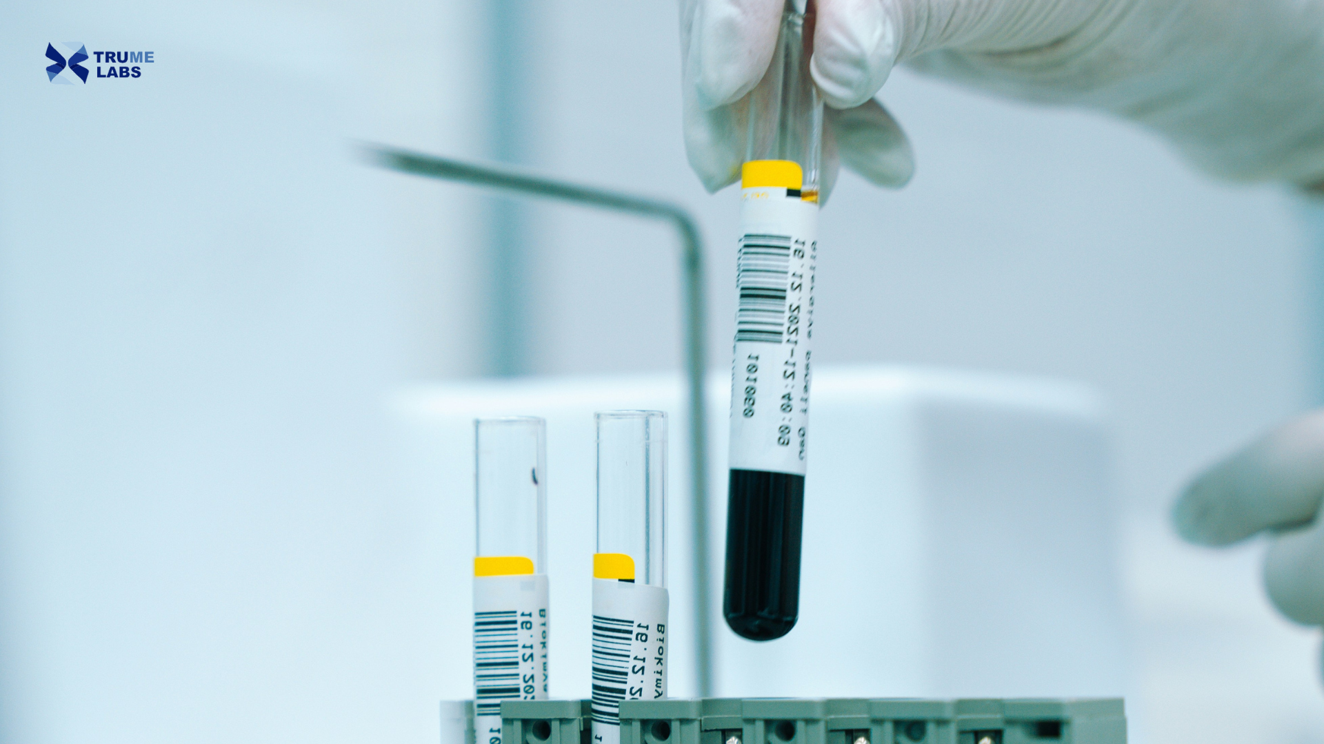 biological age blood test