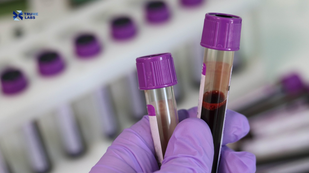 blood vs saliva for genetic testing