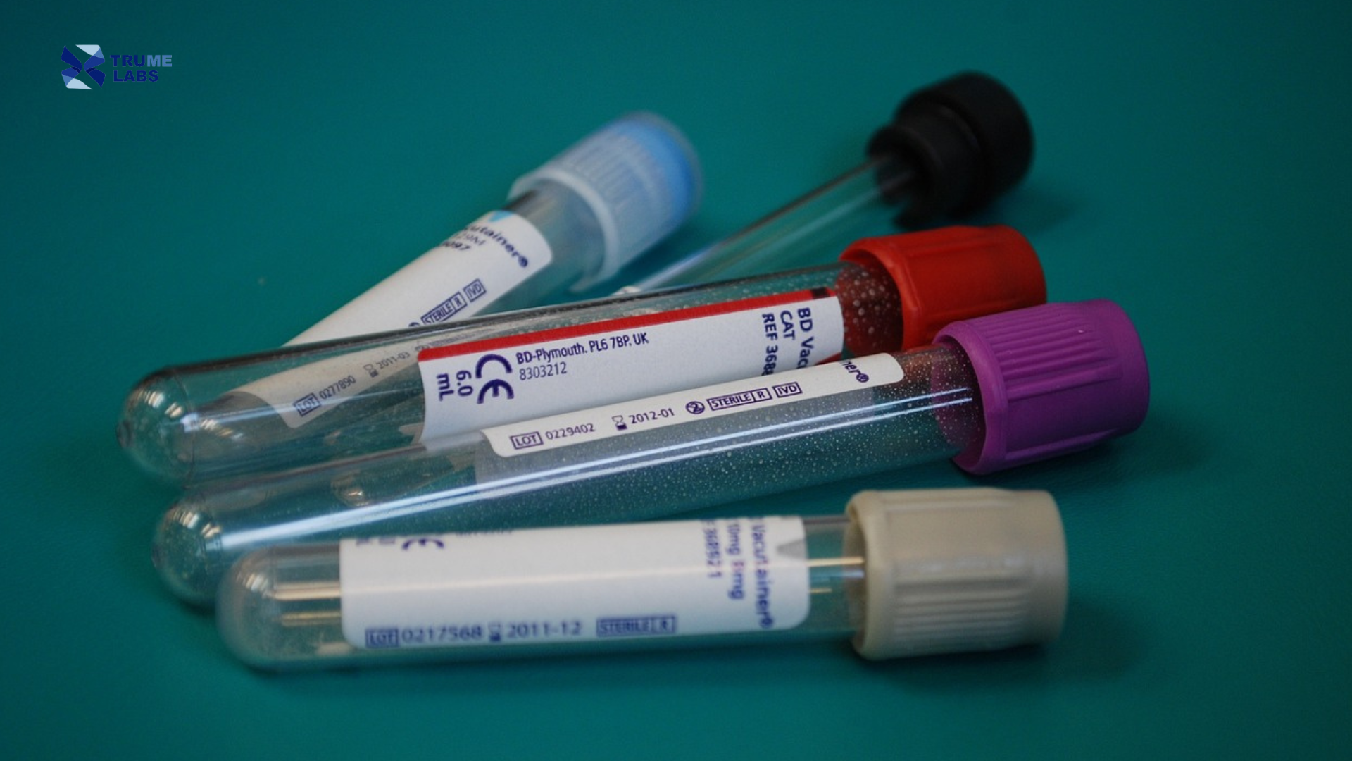 buccal swab vs blood sample for genetic testing