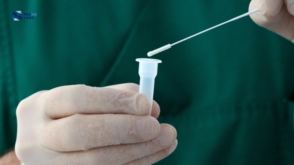saliva sampling vs buccal swab for genetic testing